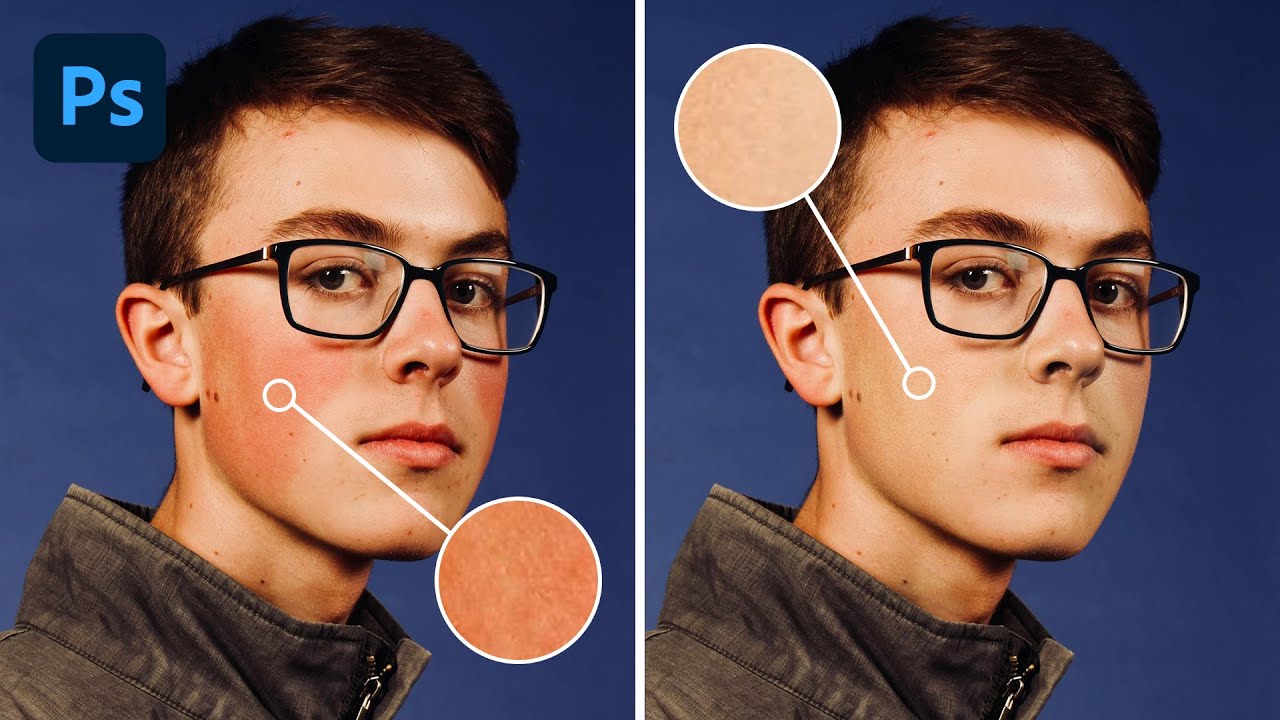 Four Ways to Fix Red Skin in Photoshop (Without Making Your Subject Look Plastic)